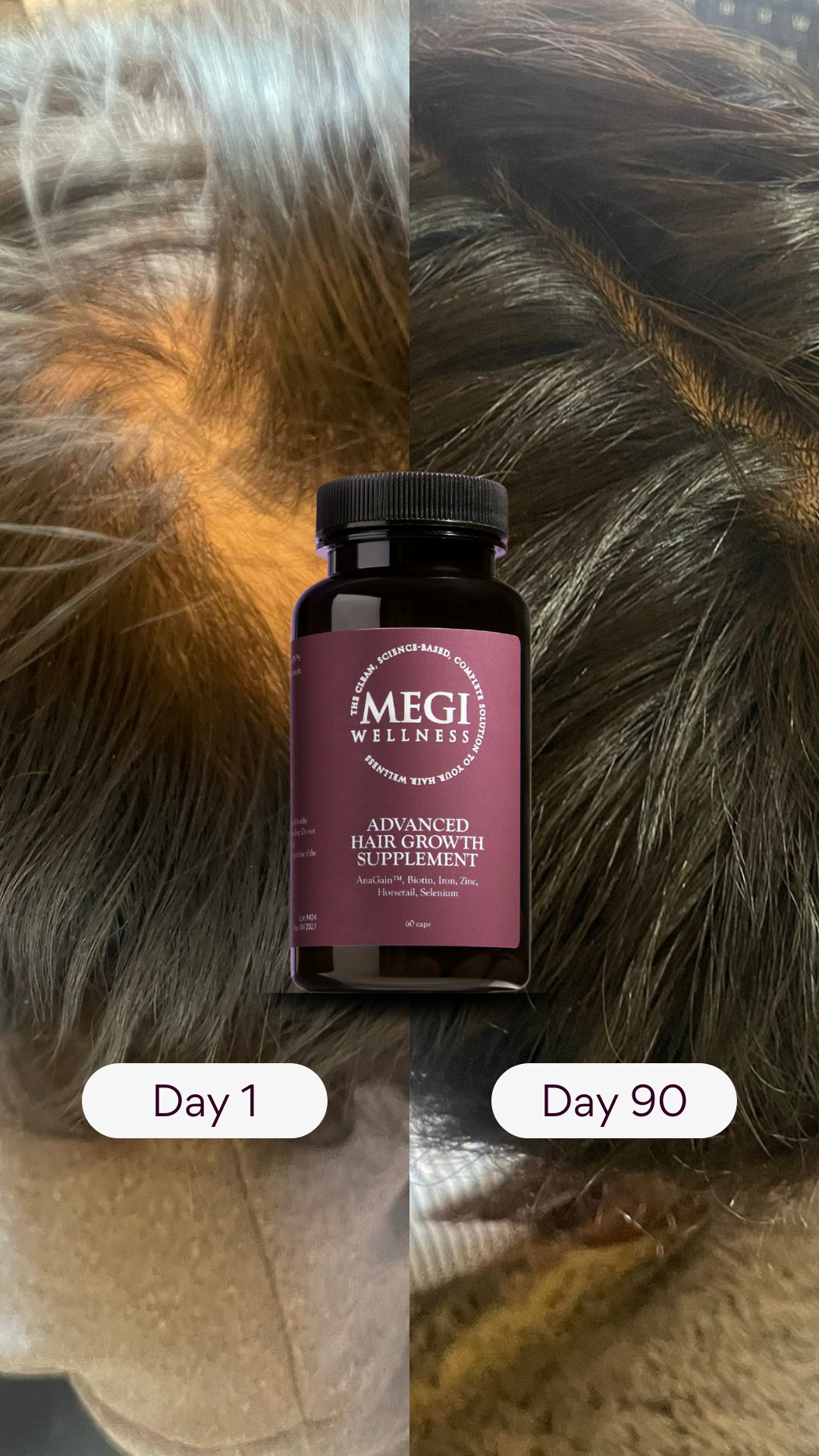 Hair Growth Serum for Thinning Hair | 89% Less Hair Loss | Megi Wellness