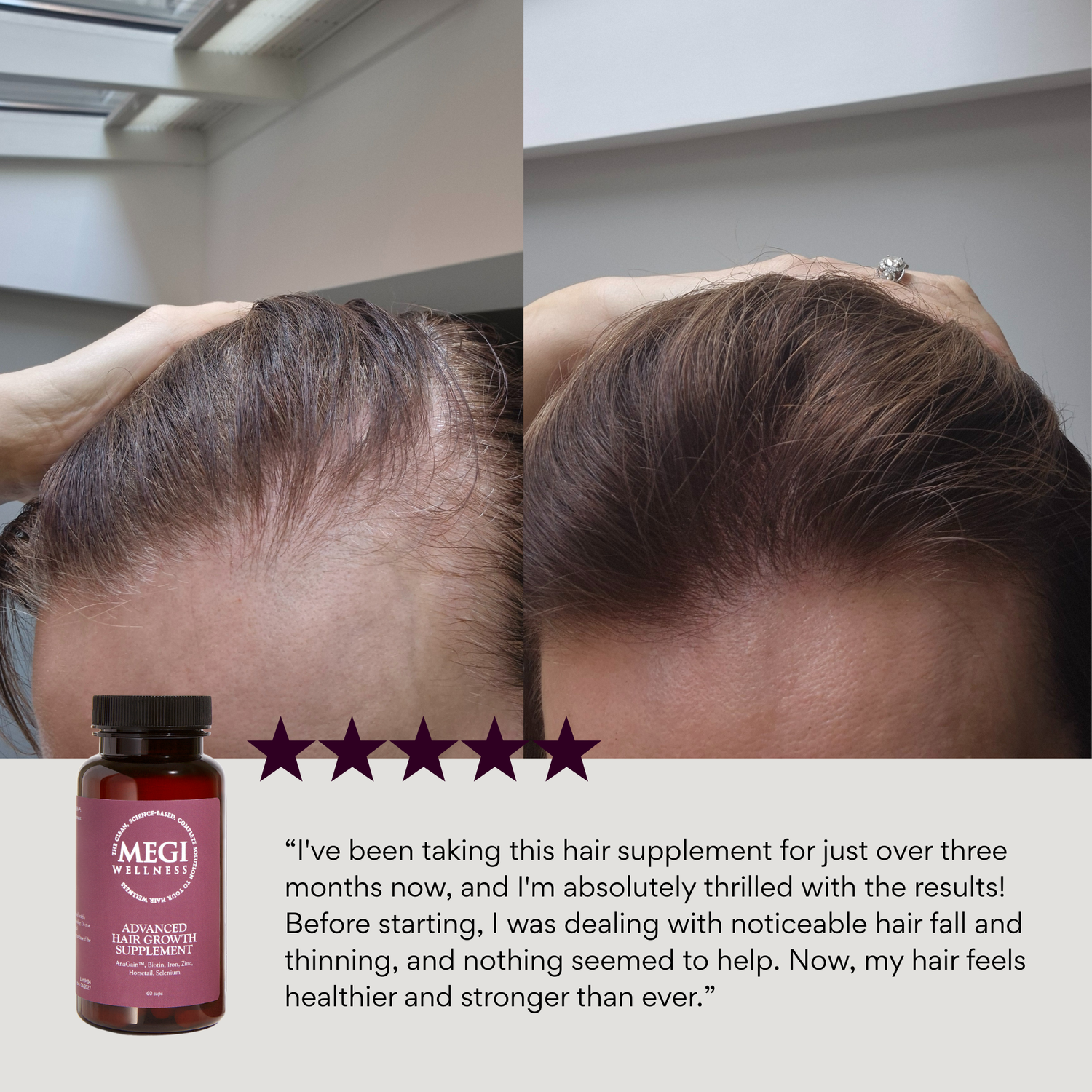 Hair supplement, vitamins with AnaGain™ Biotin, Folic Acid, Horsetail & Selenium,  hair growth, reduces hair loss , shedding