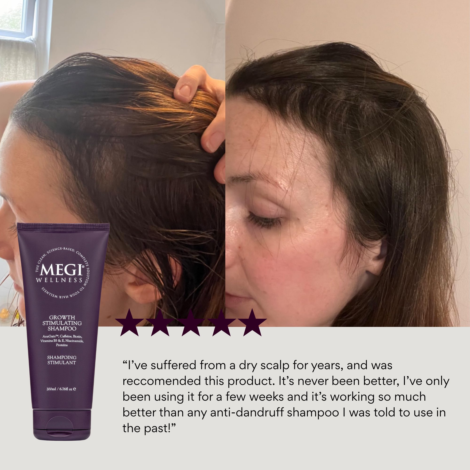 Growth-stimulating shampoo with caffeine, biotin, anagain, rosemary oil. Menopausal hair thinning. Men&