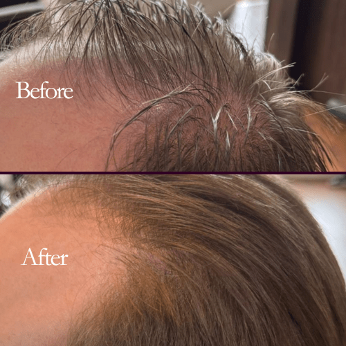 Megi® Wellness Growth Stimulating Hair Serum - MEGIWellness