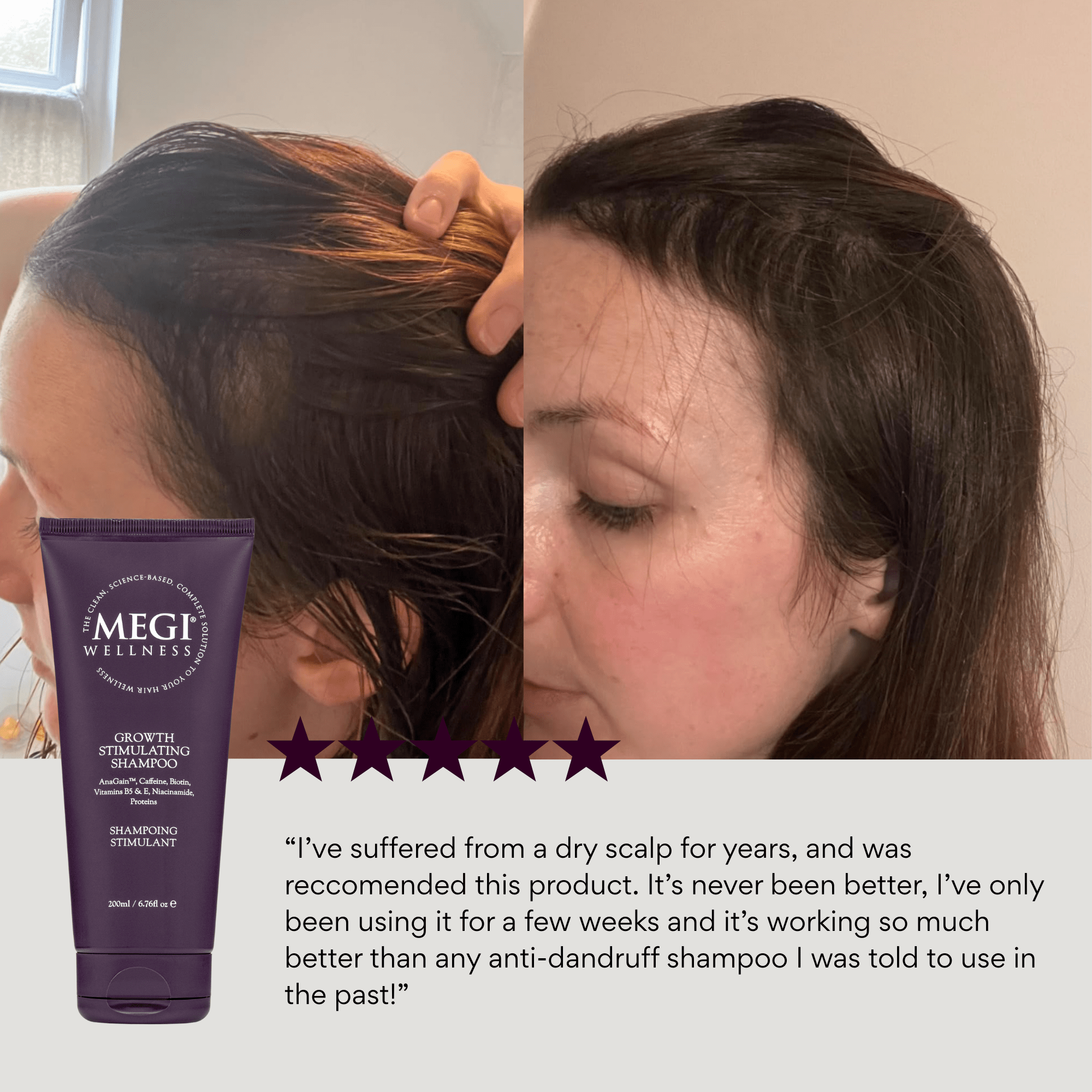 Megi® Wellness Growth Stimulating Shampoo - MEGIWellness