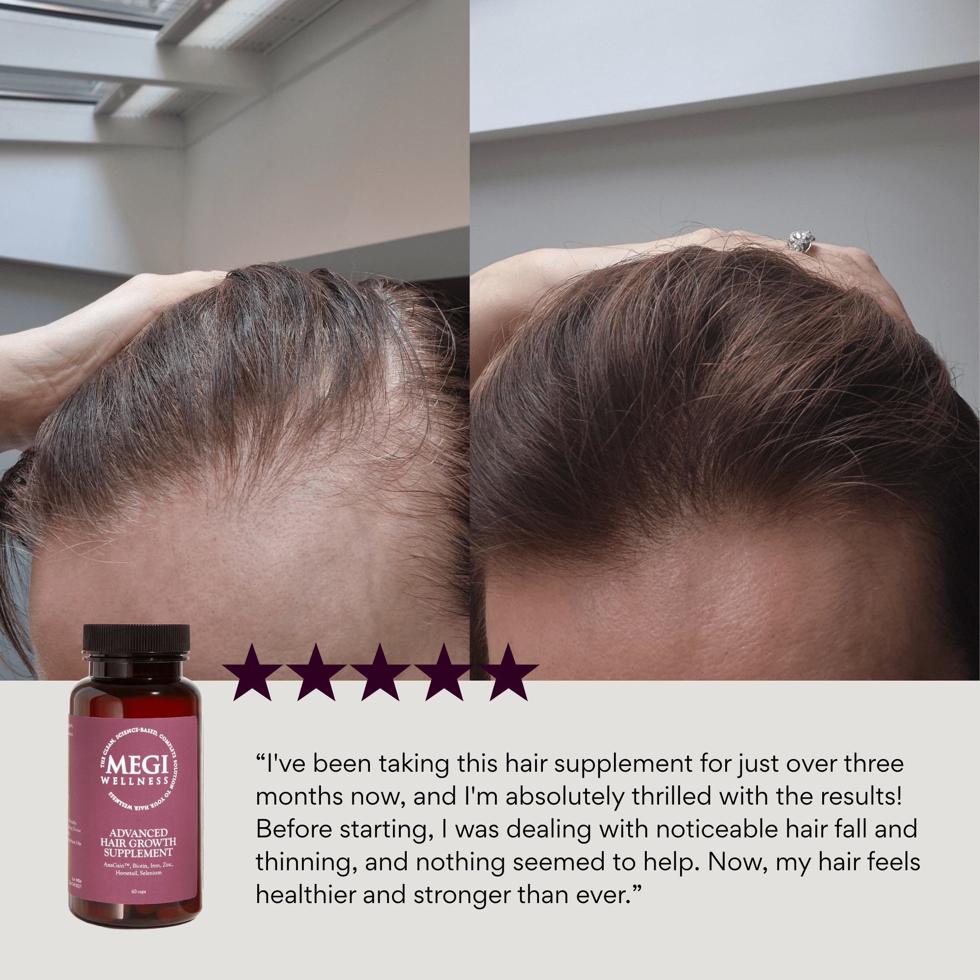 Hair supplement, vitamins with AnaGain™ Biotin, Folic Acid, Horsetail & Selenium, hair growth, reduces hair loss , shedding