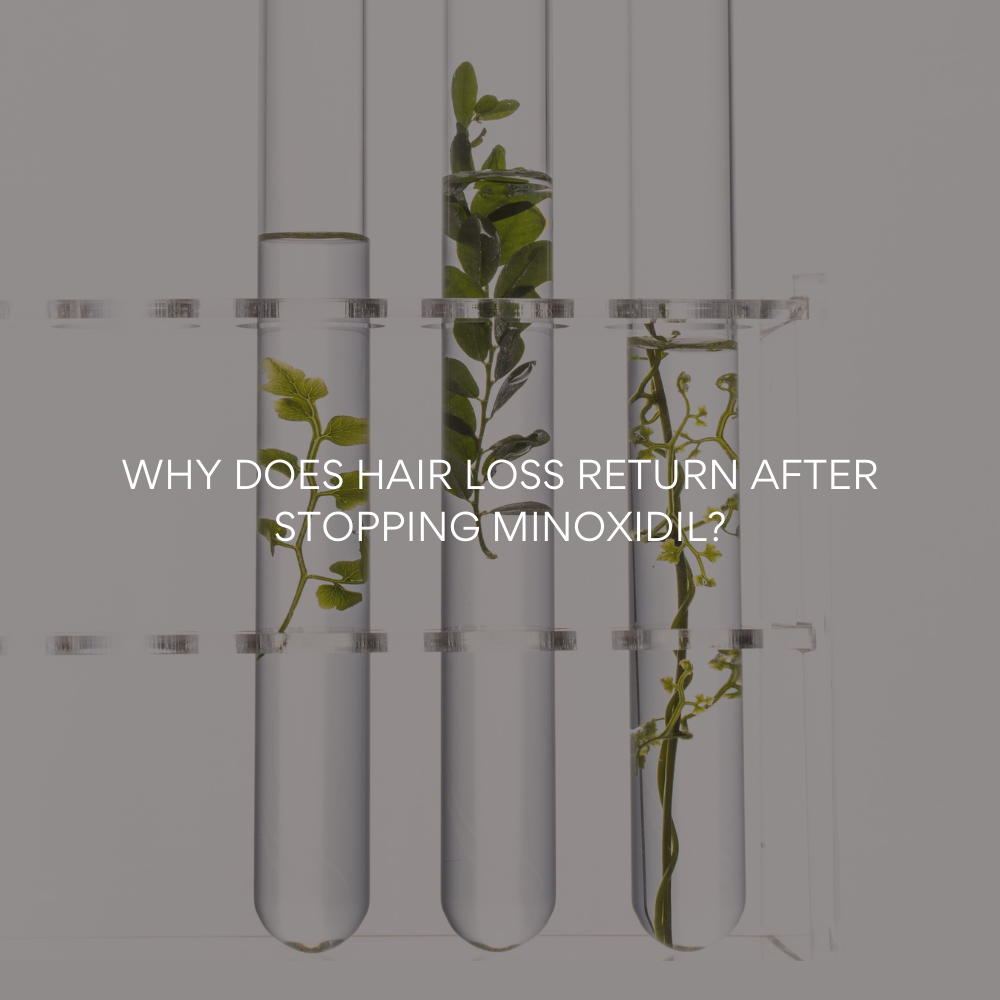 Minoxidil vs. Natural Hair Growth Serum: Why Your Hair Loss Returns (And How to Fix It for Good)