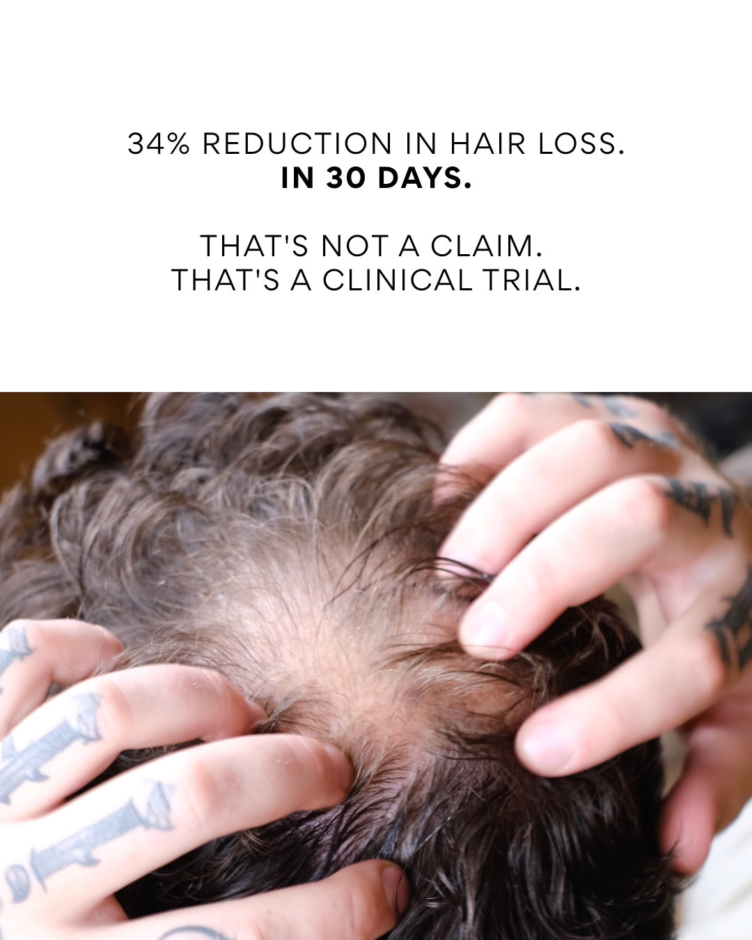 Man with thinning hair learning about DHT and natural hair loss treatments from Megi Wellness