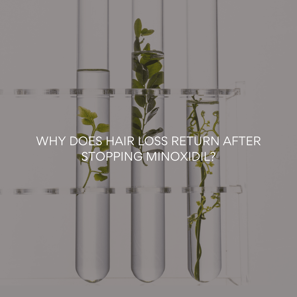 Minoxidil vs. Natural Hair Growth Serum: Why Your Hair Loss Returns (And How to Fix It for Good) - MEGIWellness