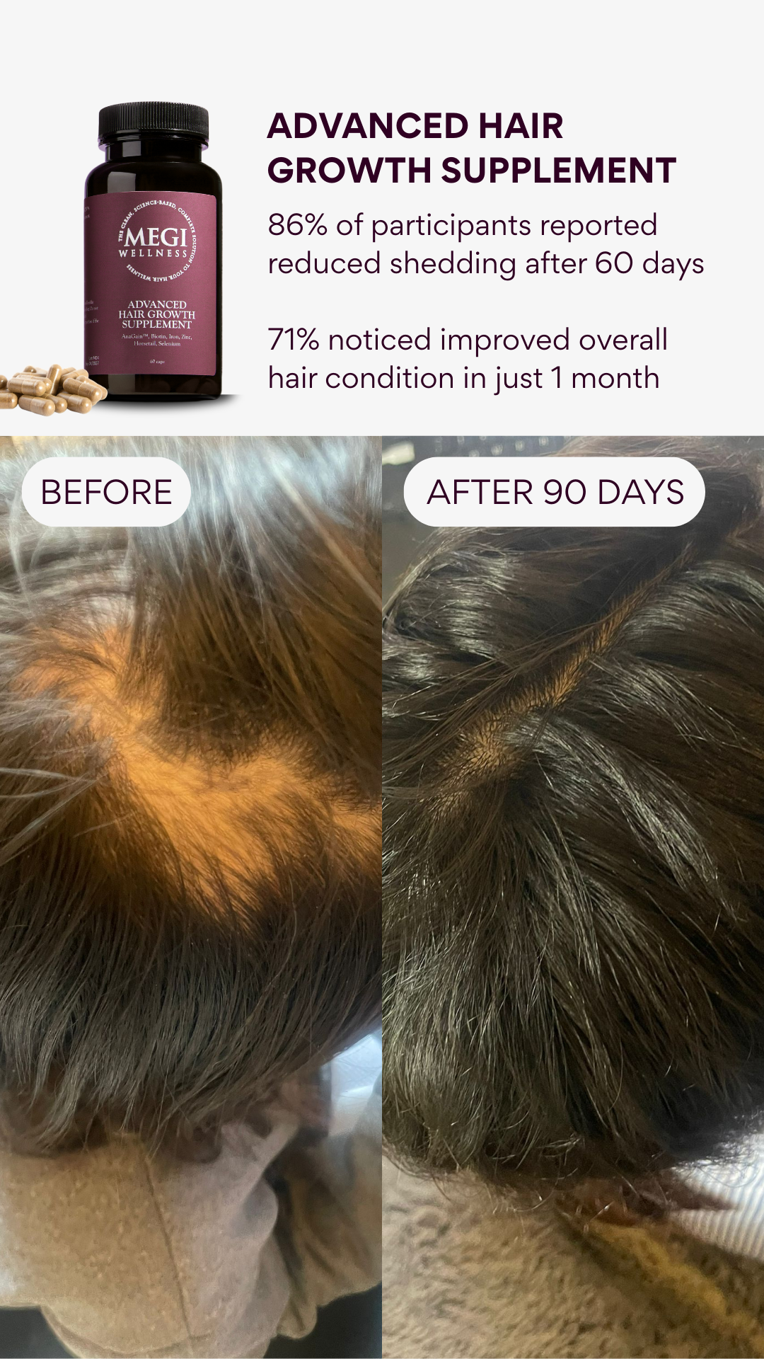 Advanced Hair Growth Supplement Bundle with FREE conditioner