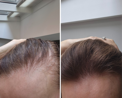 Megi® Wellness Growth Stimulating Hair Serum