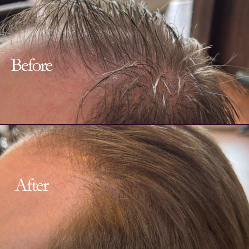 Megi® Wellness Growth Stimulating Hair Serum