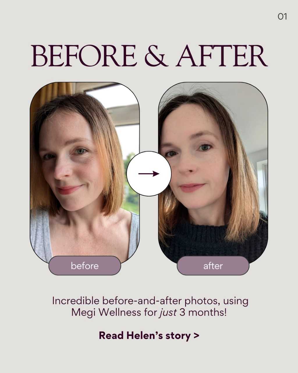 Split image reveals a woman before and after three months with Megi® Wellness Ultimate Hair Growth Set. The before shows natural lighting; the after showcases her enhanced skin tone and thicker hair. Text reads: Incredible transformation photos. Discover Helens journey.