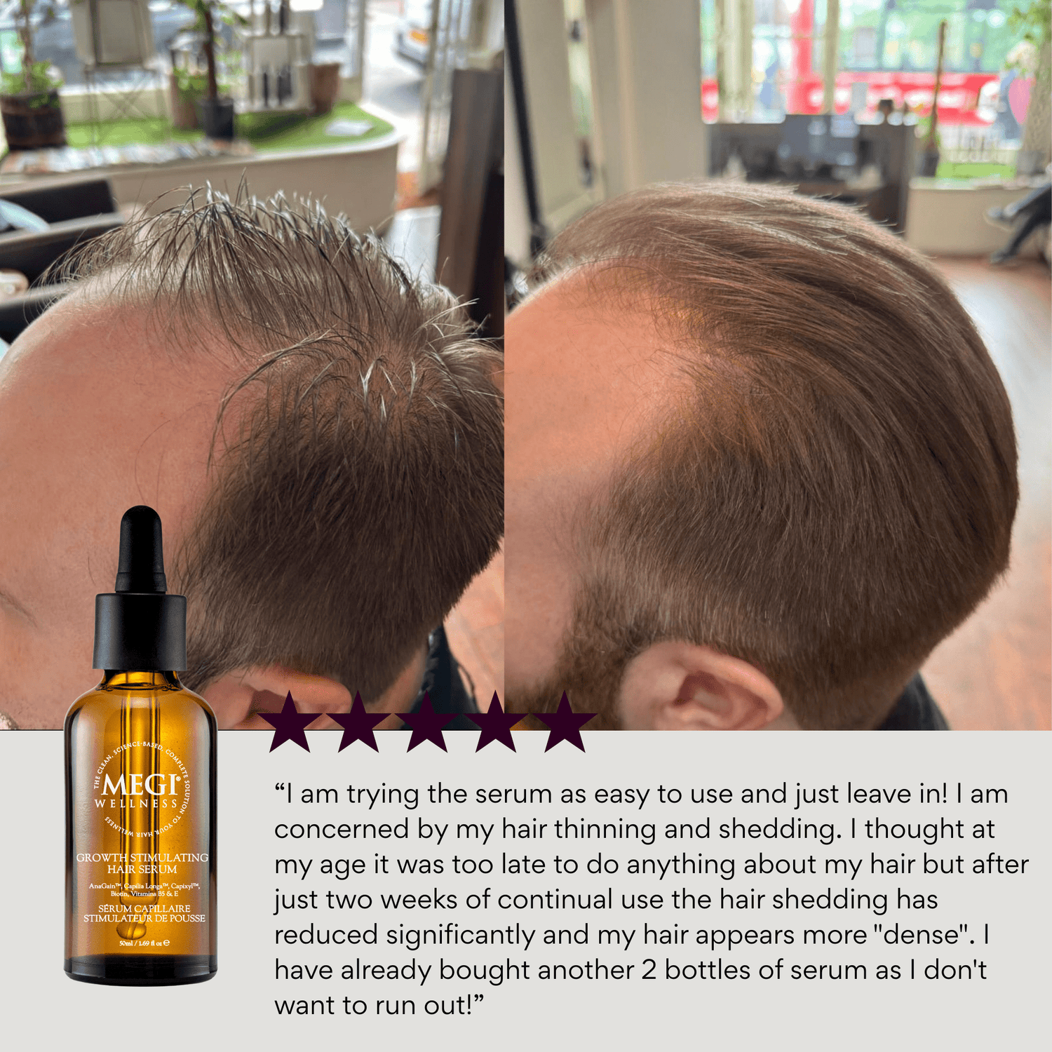 Growth-stimulating serum with caffeine, biotin, anagain,  rosemary oil. Menopausal hair thinning. Men&