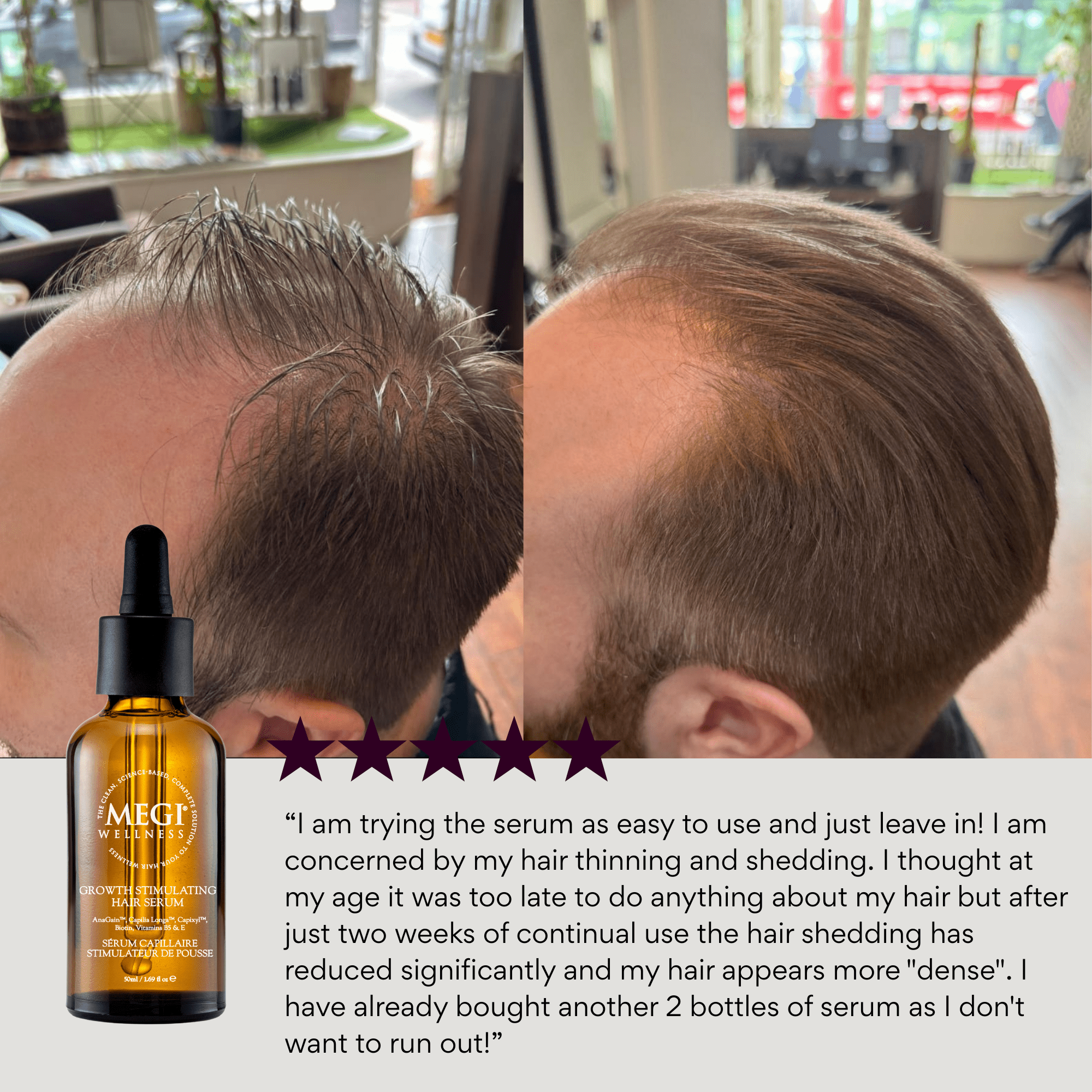 Growth-stimulating serum with caffeine, biotin, anagain,  rosemary oil. Menopausal hair thinning. Men&