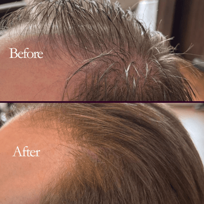 Megi® Wellness Growth Stimulating Hair Serum - MEGIWellness