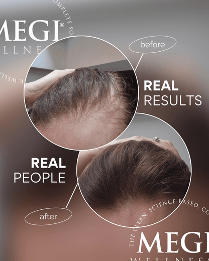 Megi® Wellness Before and after-Picture of real hair growth, regrowth. For hair loss, thining hair and  regrowth. Men and women