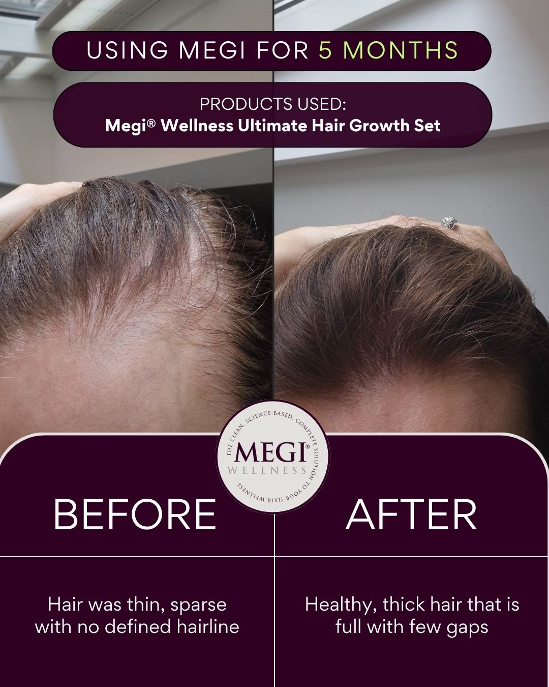 Megi® Wellness Re - Grow - MEGIWellness