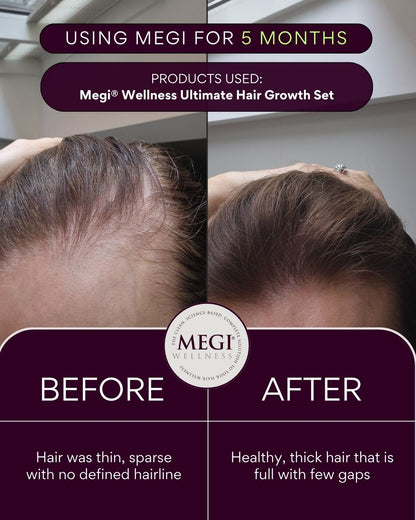 Megi® Wellness Re - Grow - MEGIWellness