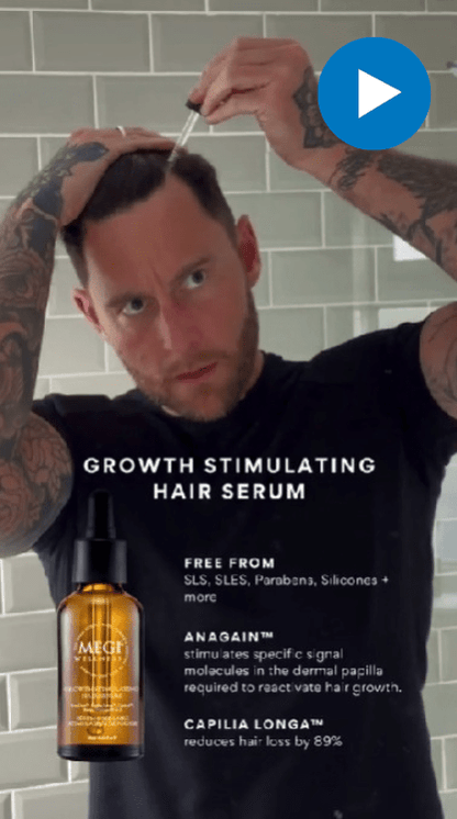 Men using  Scalp Activation Derma Roller. Scalp Microneedling