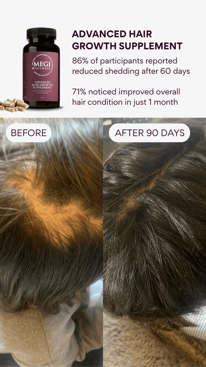 Befor and after hair loss visual for women