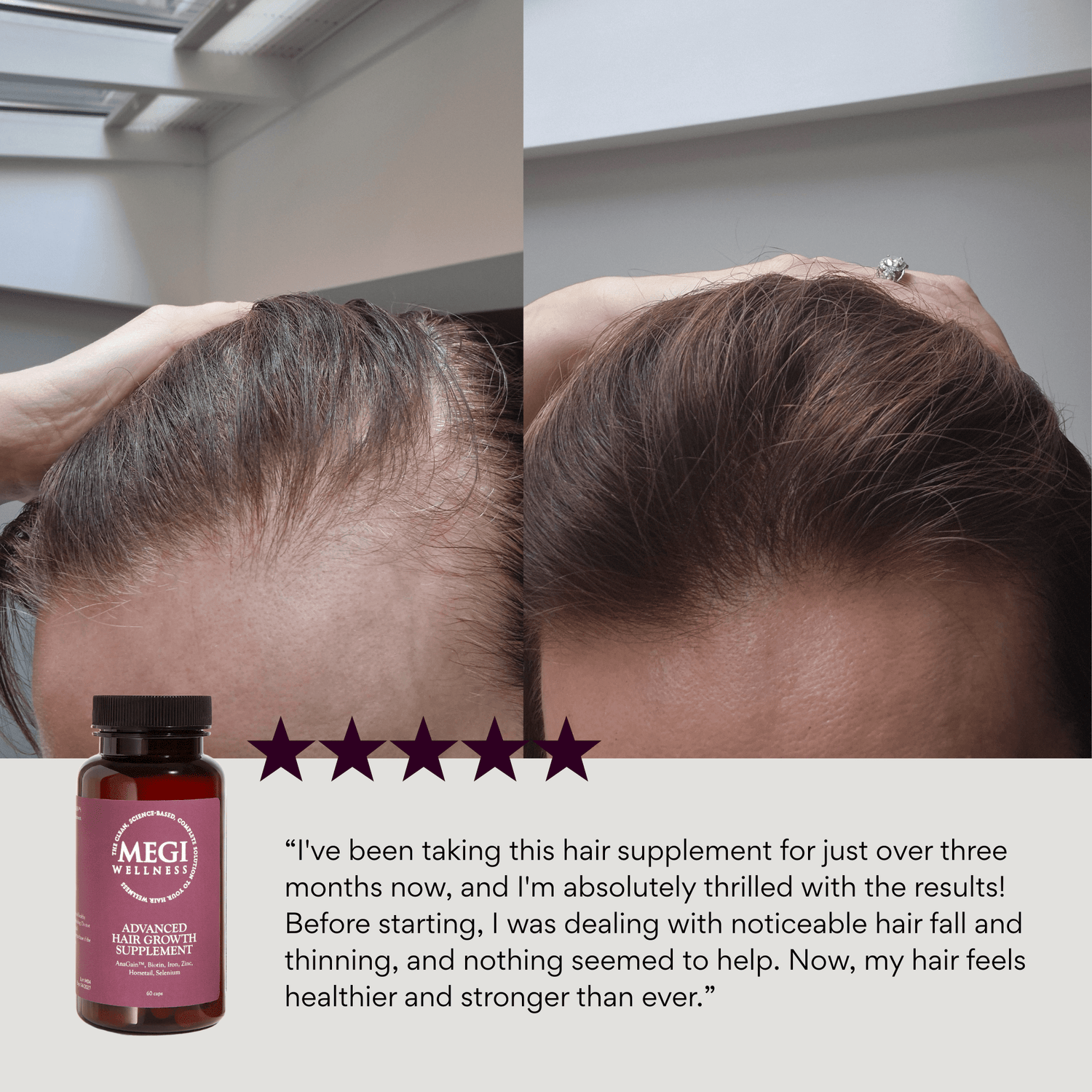 Hair supplement, vitamins with AnaGain™ Biotin, Folic Acid, Horsetail &amp; Selenium,  hair growth, reduces hair loss , shedding